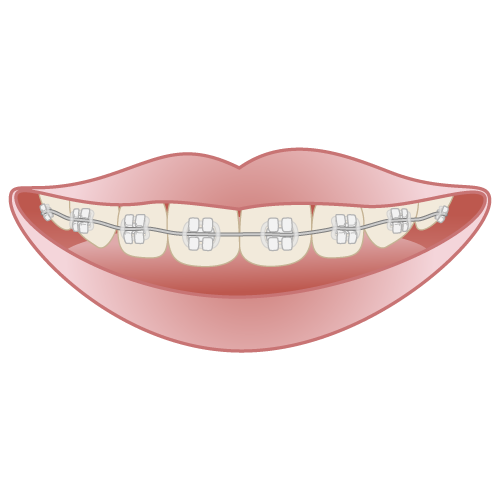 orthodontics004